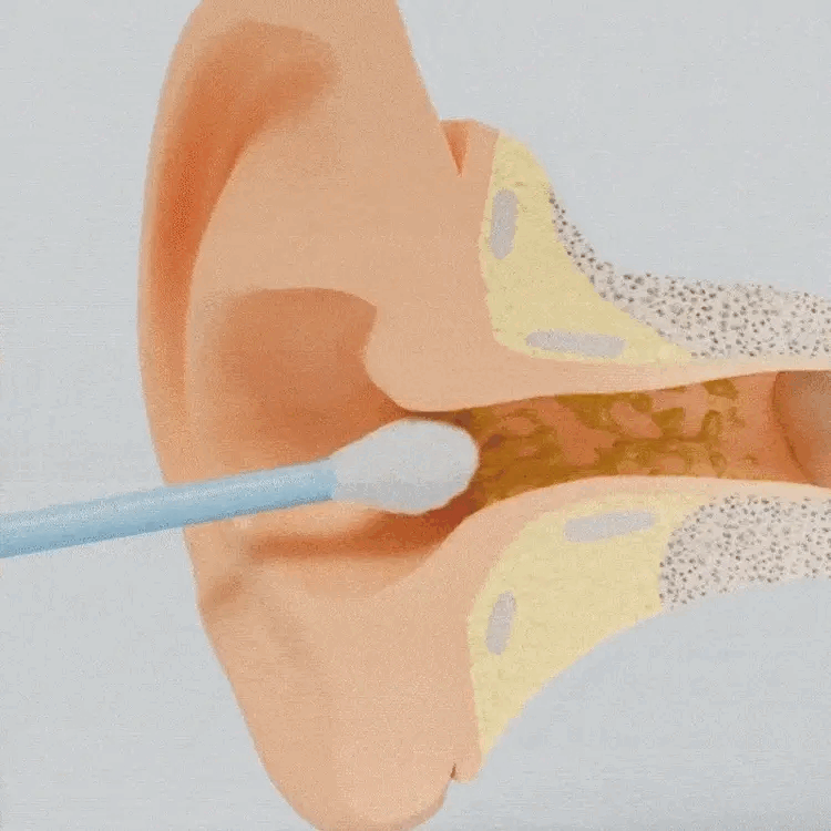 Earwax Cleaner