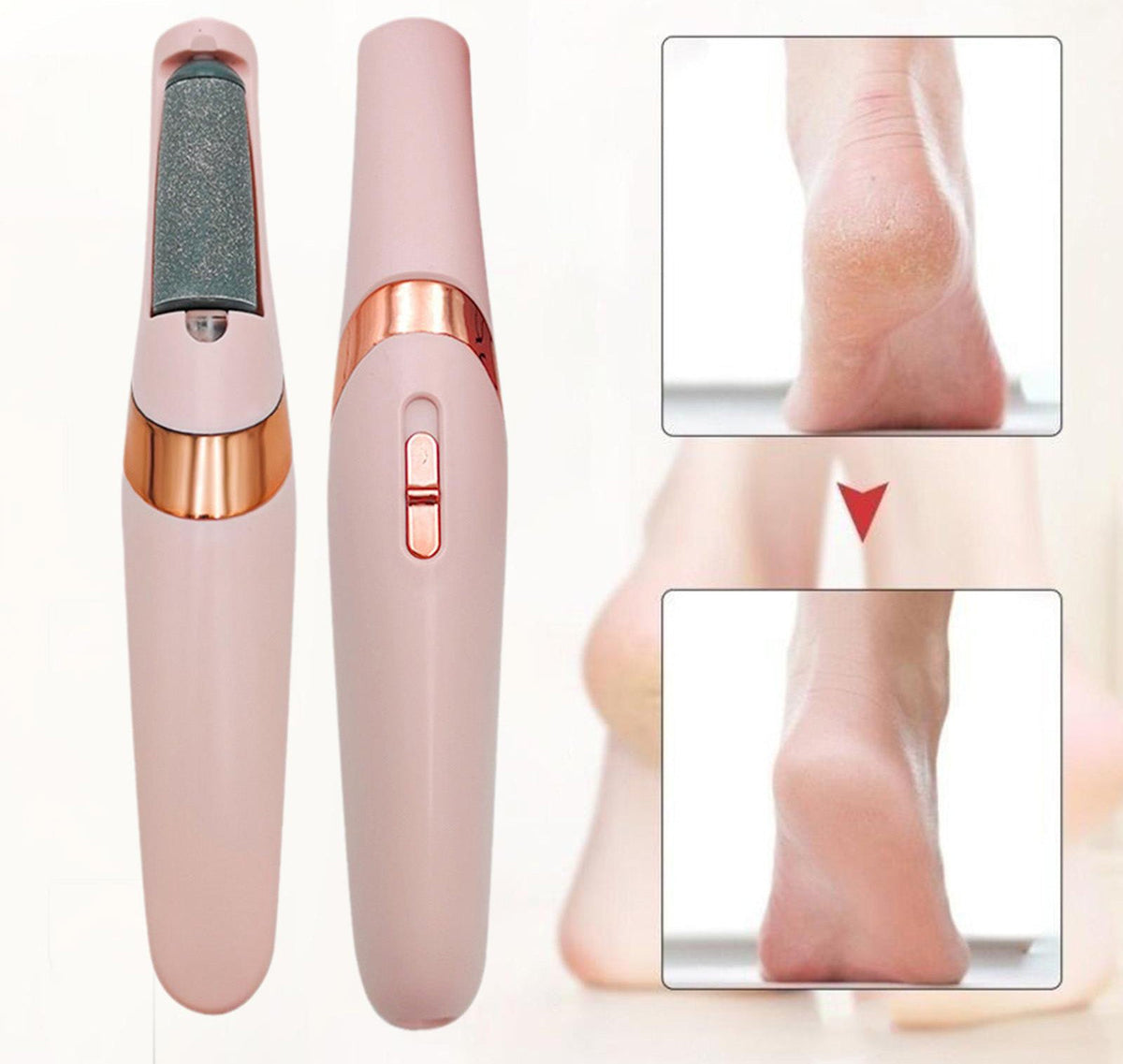 Electric Foot File
