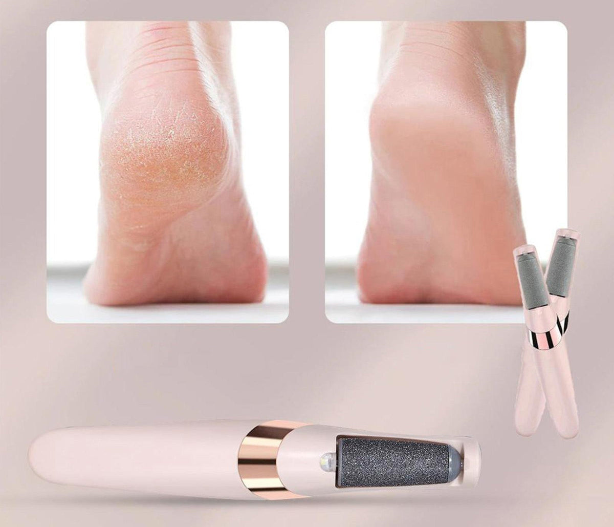 Electric Foot File