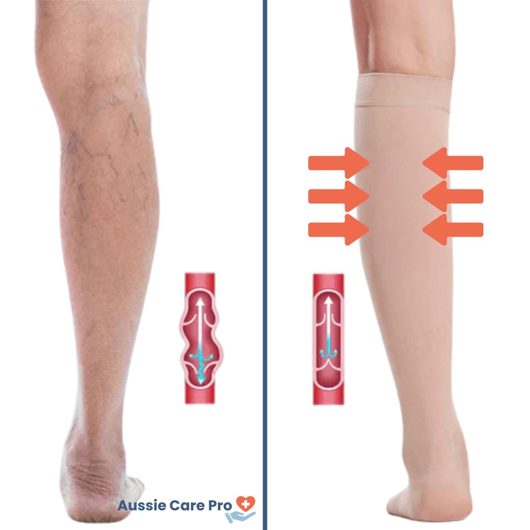 Graduated Compression Socks – Open Toe Support for Improved Blood Circulation